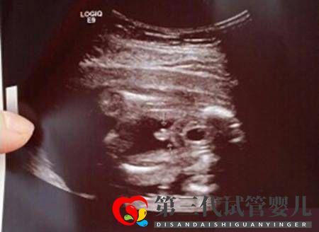 求錦鯉、望翻盤，想生男孩的她們有多努力？(圖1)