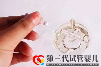 首次取卵后多久可以取第二次?(圖1) 首次取卵后多久可以取第二次?(圖1)