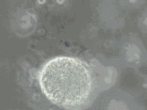 精子碎片率高可以做三代試管嬰兒嗎?(圖1) 精子碎片率高可以做三代試管嬰兒嗎?(圖1)