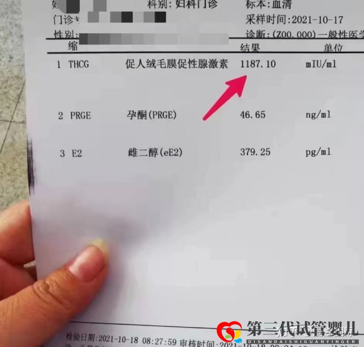 試管嬰兒第三代技術包成功“生男孩”真的可以生兒子(圖2)