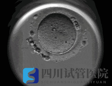 成都試管嬰兒醫院引進“時差培養箱”，助力篩選更具發育潛力的胚胎(圖2)