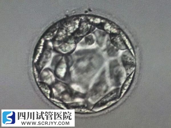 養囊后移植成功率更高