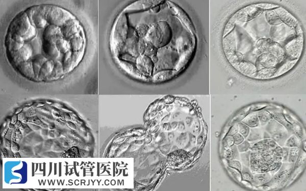 家族遺傳會讓囊胚分裂成雙胞胎