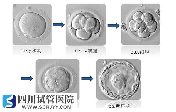 單囊胚變成雙胞胎的幾率約20%